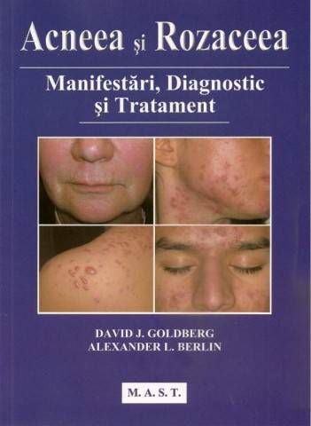 Cartea Acneea si rozaceea - David J. Goldberg de Berg
