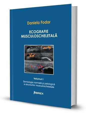 Cartea Ecografie musculoscheletala Vol.1 - Daniela Fodor de Daniela Fodor