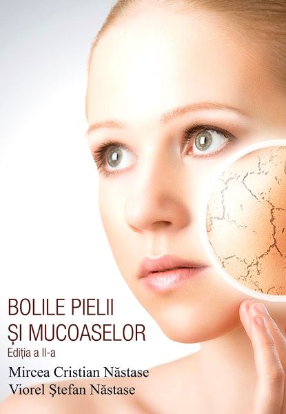Cartea Bolile pielii si mucoaselor - Mircea Cristian Nastase, Viorel Stefan Nastase de Bolile pielii si mucoaselor - Mircea Cristian Nastase, Viorel Stefan Nastase