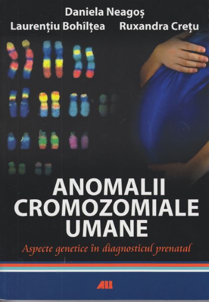 Cartea Anomalii cromozomiale umane - Daniela Neagos, Laurentiu Bohiltea, Ruxandra Cretu de Anomalii cromozomiale umane - Daniela Neagos, Laurentiu Bohiltea, Ruxandra Cretu
