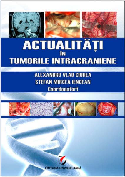 Cartea Actualitati in tumorile intracraniene - Alexandru Vlad Ciurea, Stefan Mircea Iencean de Alexandru Vlad Ciurea, Stefan Mircea Iencean