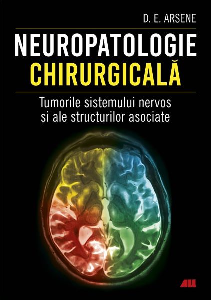 Cartea Neuropatologie chirurgicala. Tumorile sistemului nervos - Dr. Dorel Eugen Arsene de Dorel Eugen Arsene