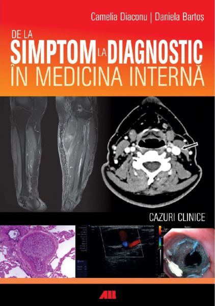 Cartea De la simptom la diagnostic in medicina interna - Camelia Diaconu, Daniela Bartos