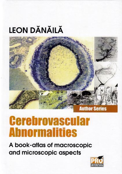 Cartea Cerebrovascular abnormalities - Leon Danaila